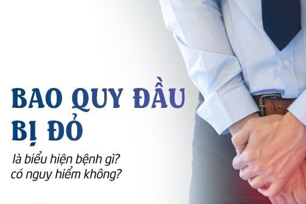 Bao quy đầu bị đỏ là biểu hiện bệnh gì? Có nguy hiểm không?