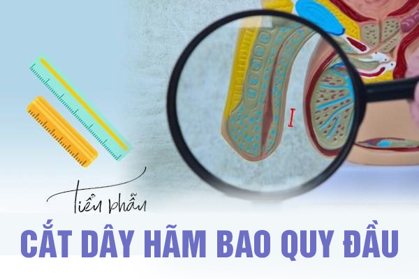 Tiểu phẫu cắt dây hãm bao quy đầu ở nam giới