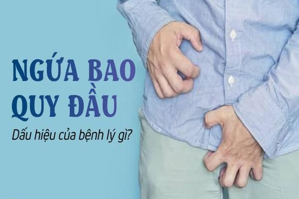 Ngứa bao quy đầu là dấu hiệu bị bệnh lý gì?