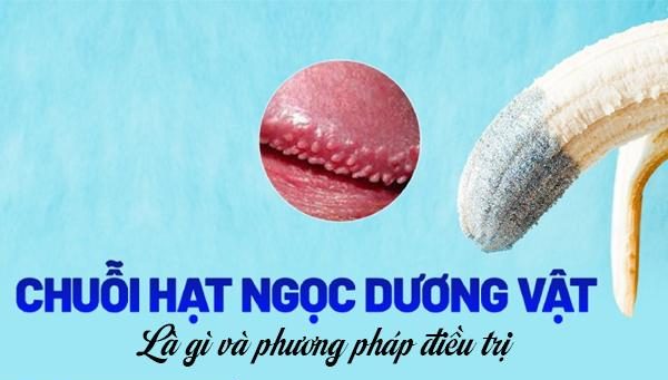 Chuỗi hạt ngọc dương vật là gì? Phương pháp điều trị hiệu quả