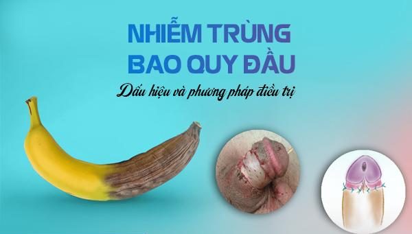 Nhiễm trùng bao quy đầu: Dấu hiệu và phương pháp điều trị