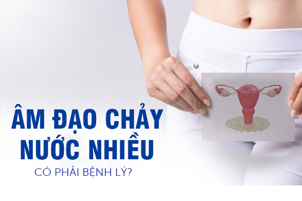 Âm đạo chảy nước nhiều có phải là bị bệnh lý?