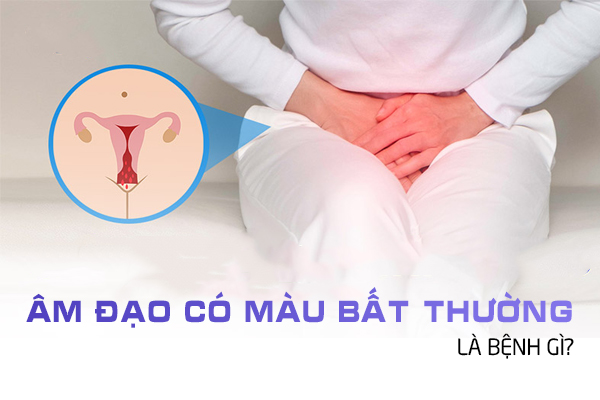 Âm đạo có màu bất thường là bệnh gì?