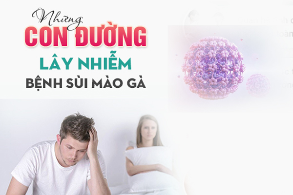 Bệnh sùi mào gà lây qua đường nào?
