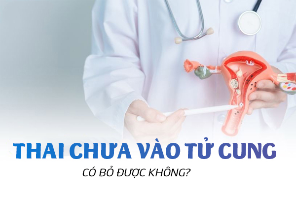 Bỏ thai khi chưa vào tử cung có được không?
