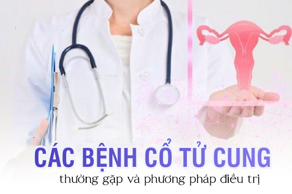 Các bệnh cổ tử cung thường gặp và phương pháp điều trị