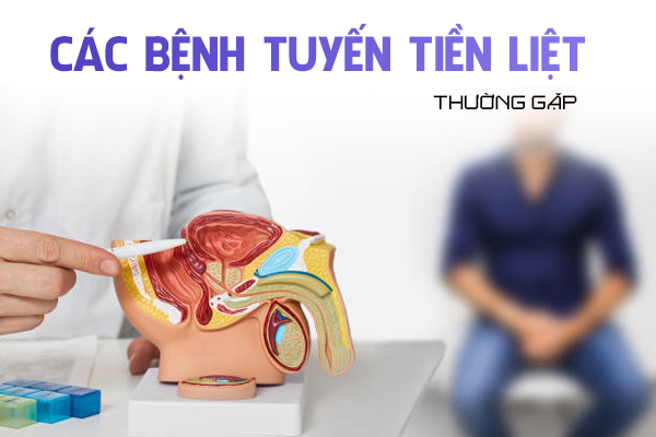Các bệnh tuyến tiền liệt thường gặp