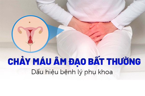 Chảy máu âm đạo – Dấu hiệu bệnh lý phụ khoa