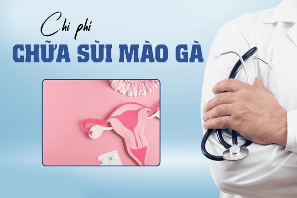 Chi phí chữa sùi mào gà tiết kiệm tại Đắk Lắk