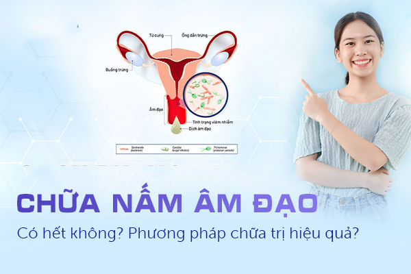 Chữa nấm âm đạo có hết không? Phương pháp chữa trị hiệu quả