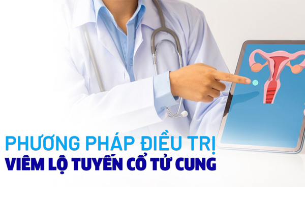 Chữa trị viêm lộ tuyến bằng cách nào hiệu quả?