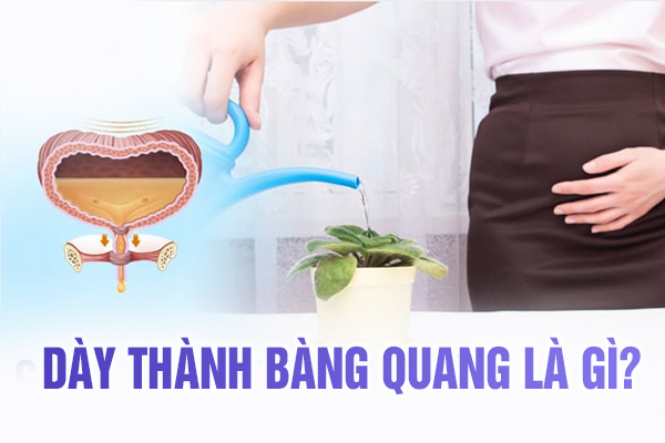 Dày thành bàng quang là gì?