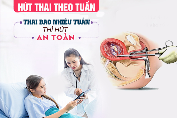 Hút thai theo tuần: Thai bao nhiêu tuần hút an toàn?