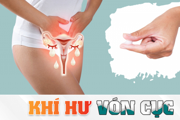Khí hư là gì? Thế nào là khí hư vón cục?