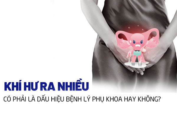 Khí hư ra nhiều có phải là bị bệnh lý phụ khoa không?