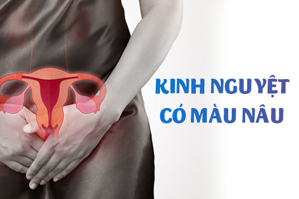 Kinh nguyệt có màu nâu là dấu hiệu của bệnh gì?