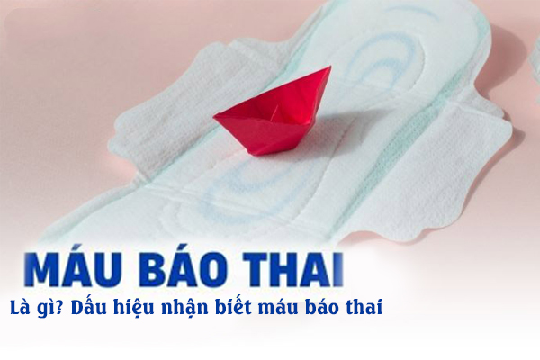 Máu báo thai là gì? Dấu hiệu nhận biết máu báo thai