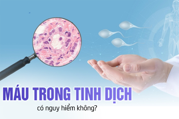 Máu trong tinh dịch có nguy hiểm không?