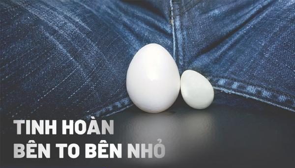 Nam giới lo lắng tinh hoàn bên to bên nhỏ