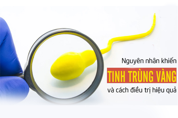 Nguyên nhân tinh trùng màu vàng và cách điều trị hiệu quả