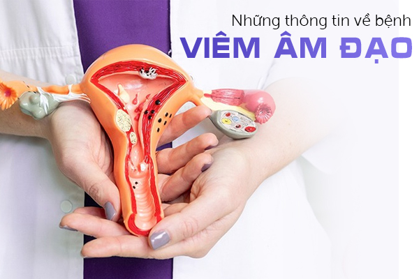 Những thông tin về bệnh viêm âm đạo