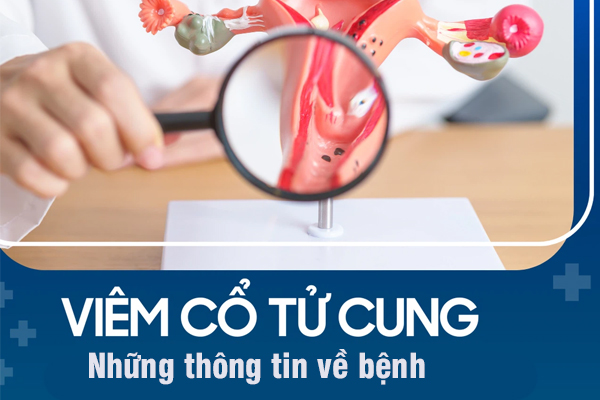 Những thông tin về bệnh viêm cổ tử cung