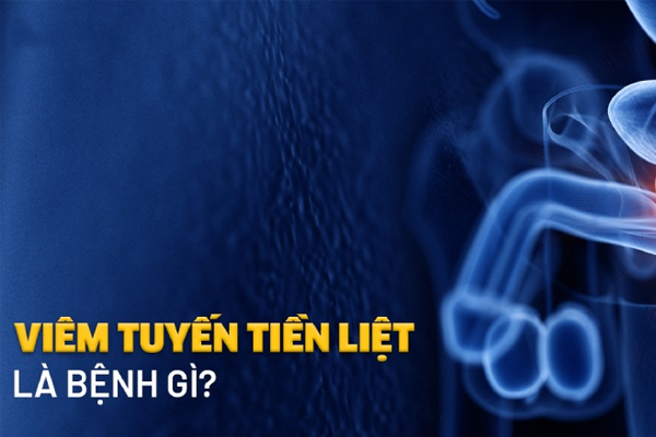 Những thông tin về viêm tuyến tiền liệt
