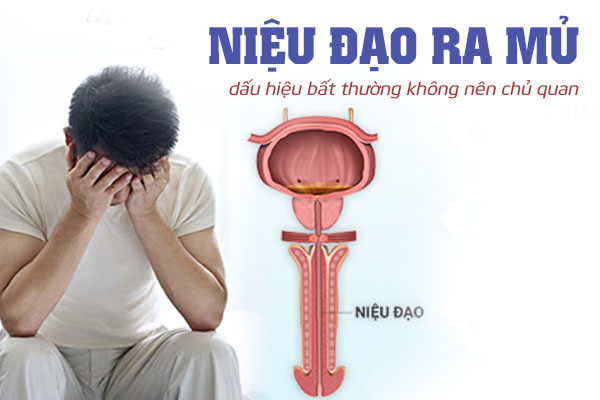 Niệu đạo chảy ra mủ dấu hiệu bất thường không nên chủ quan