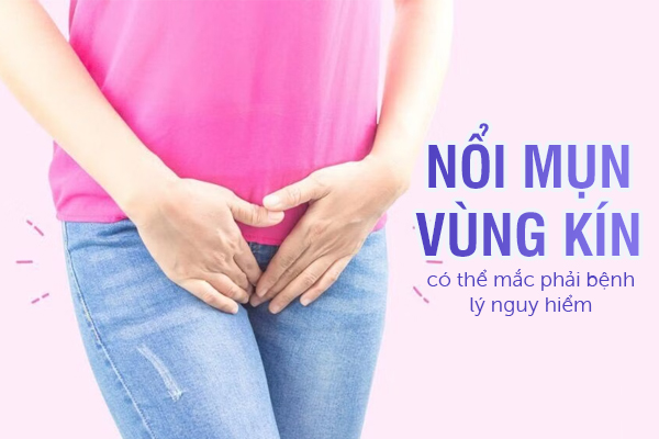 Nổi mụn vùng kín có thể mắc phải bệnh lý nguy hiểm