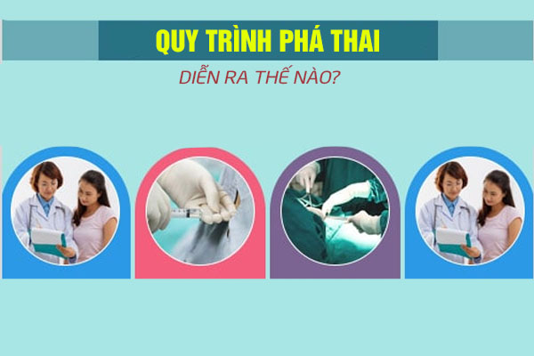 Quy trình phá thai diễn ra như thế nào?