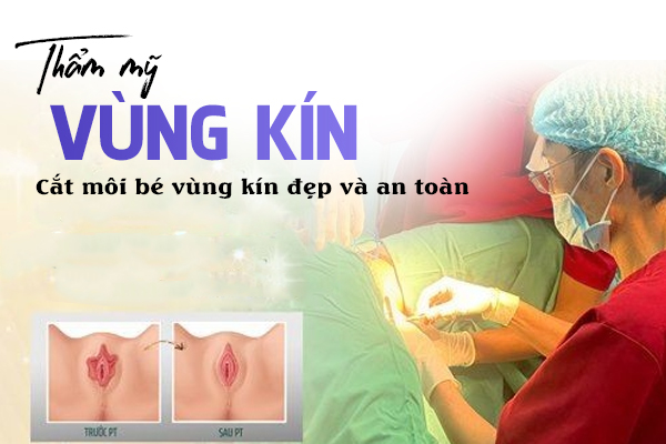 Thẩm mỹ vùng kín – Cắt môi bé vùng kín đẹp và an toàn