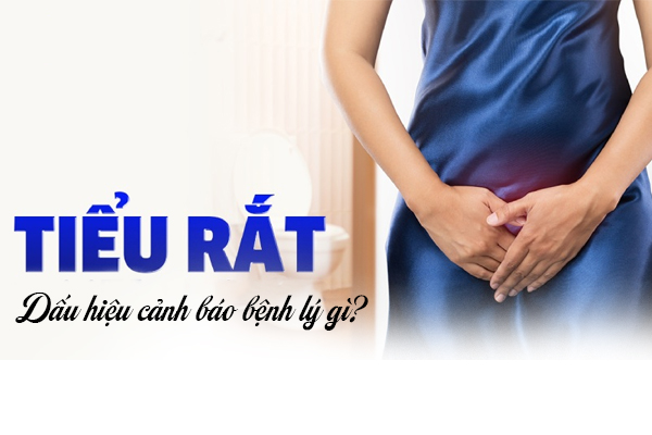 Thế nào là tiểu dắt? Dấu hiệu cảnh báo bệnh lý gì?