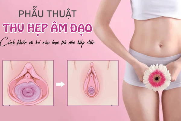 Thu hẹp âm đạo – Cách khiến cô bé của bạn trở nên hấp dẫn