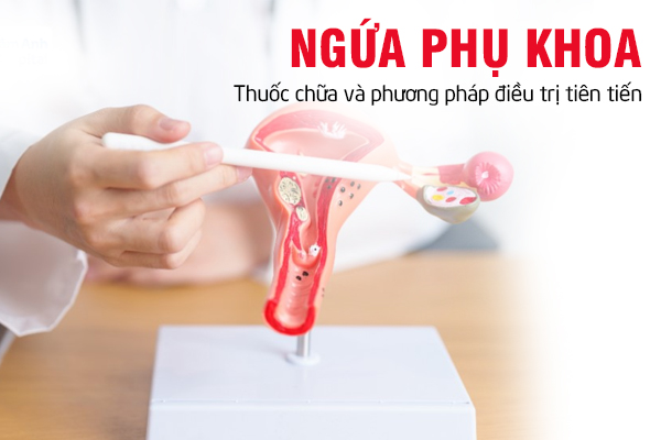 Thuốc chữa ngứa phụ khoa và phương pháp điều trị tiên tiến