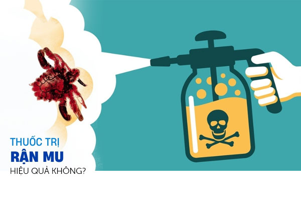 Thuốc chữa rận mu hiệu quả không? Cách chữa rận mu hiện nay