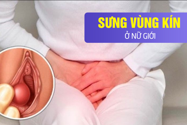 Tìm hiểu bệnh sưng vùng kín ở nữ giới