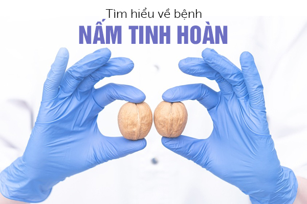 Tìm hiểu về bệnh nấm tinh hoàn ở nam giới