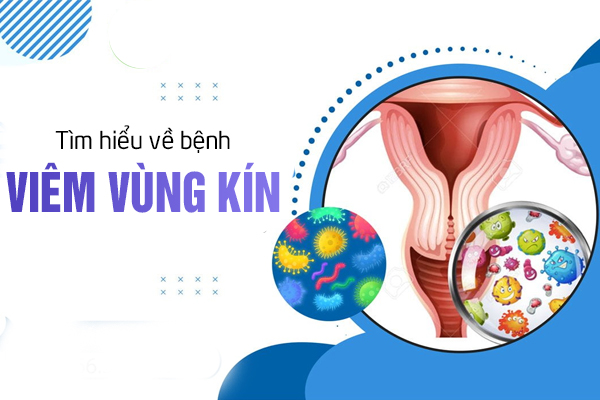 Tìm hiểu về bệnh viêm vùng kín ở nữ giới