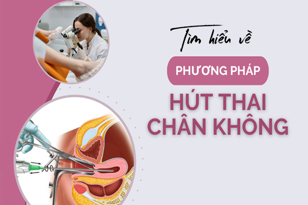Tìm hiểu về phương pháp hút thai chân không