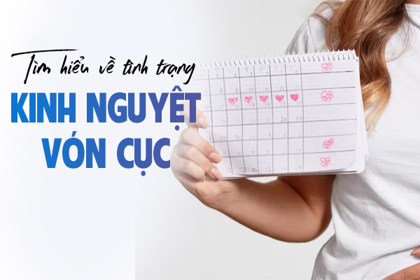 Tìm hiểu về tình trạng kinh nguyệt vón cục