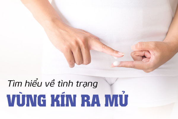 Tìm hiểu về tình trạng vùng kín ra mủ