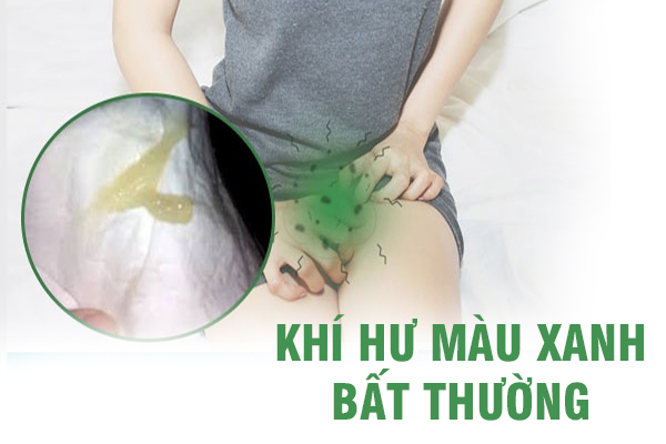 Tình trạng khí hư có màu xanh bất thường