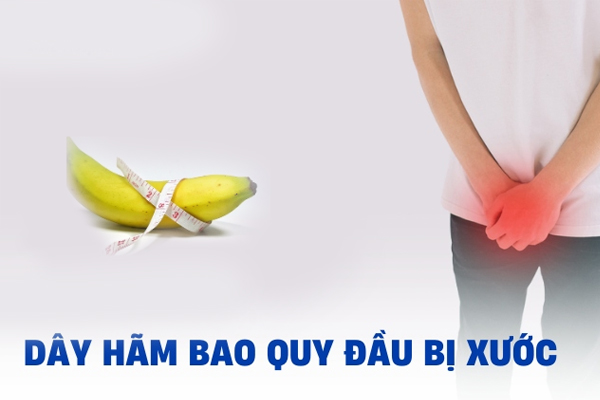 Tình trạng xước dây hãm bao quy đầu (dương vật)
