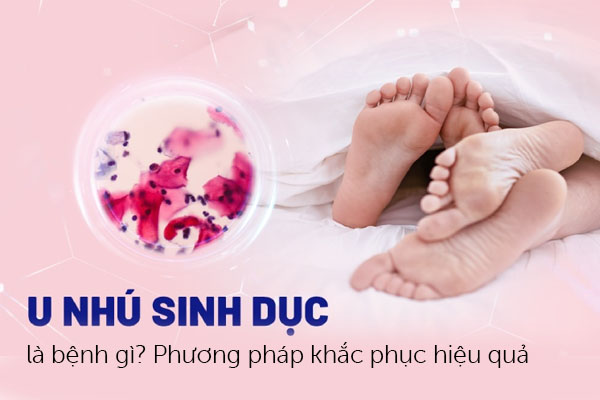 U nhú sinh dục là bệnh gì? Phương pháp khắc phục hiệu quả