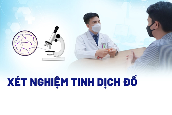 Xét nghiệm tinh dịch đồ kết quả chính xác nhất