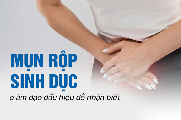Mụn rộp sinh dục ở âm đạo dấu hiệu dễ nhận biết