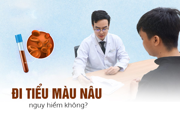 Đi tiểu màu nâu nguy hiểm không?