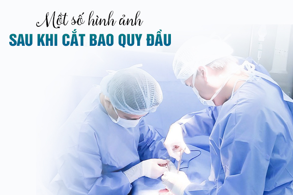 Một số hình ảnh sau khi cắt bao quy đầu