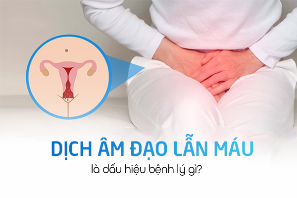 Dịch âm đạo có lẫn máu là dấu hiệu bệnh lý gì?